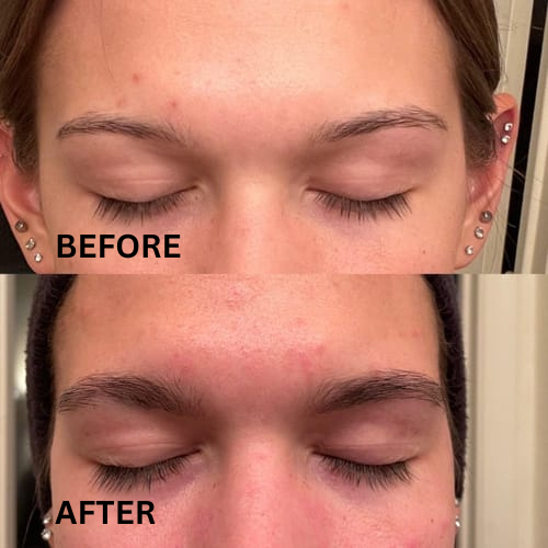 BrowFixx™ - Peel-off eyebrow gel
