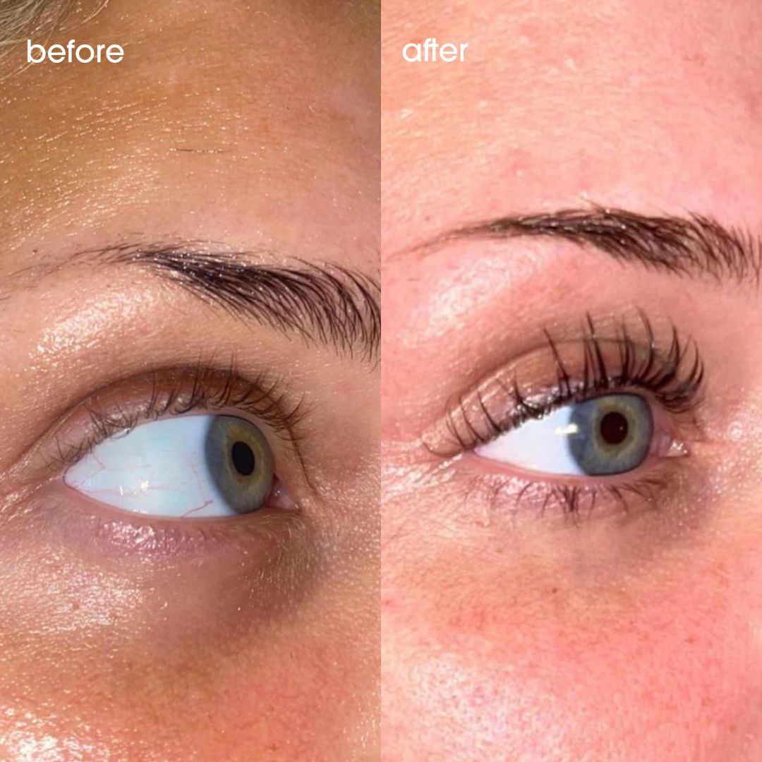 Lashbloom™ Eyelash Growth Serum